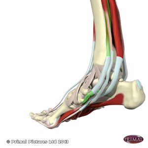 Shin splints